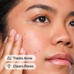 Salicylic Acid 2% Solution - Image 2